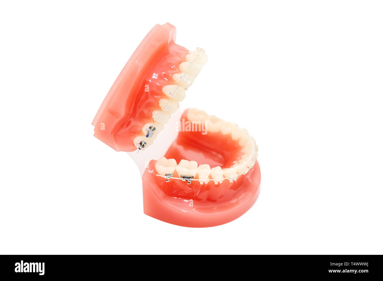 Orthodontic model and dentist tool - demonstration teeth model with ceramic braces on teeth on an artificial jaws closeup Stock Photo