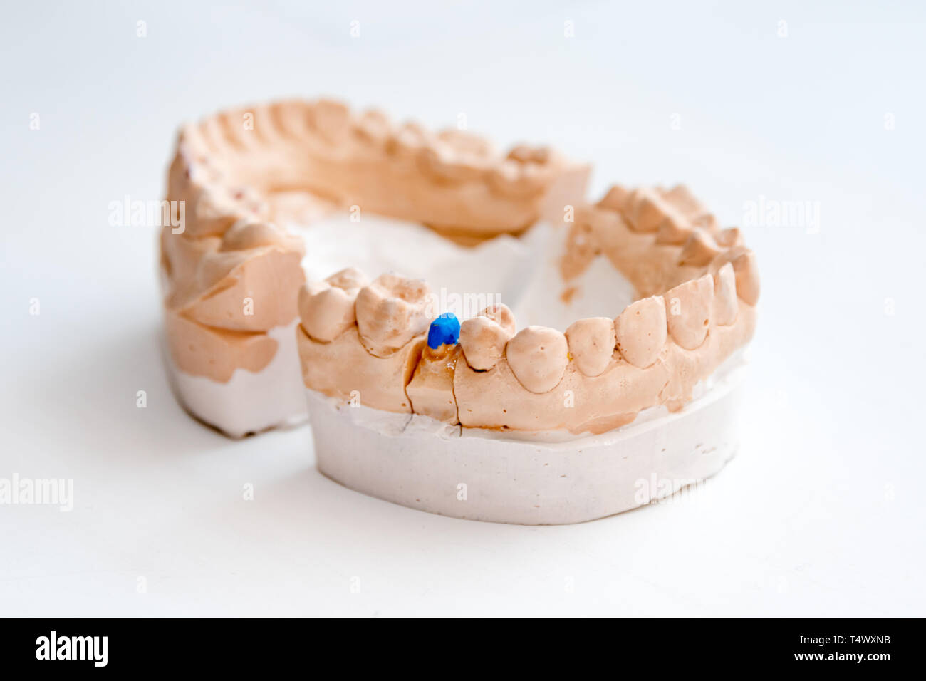 Plaster Cast of jaws. Dental casting gypsum model human Jaws in prosthetic laboratory. Dentistry, Orthodontics. Close up. selective focus Stock Photo
