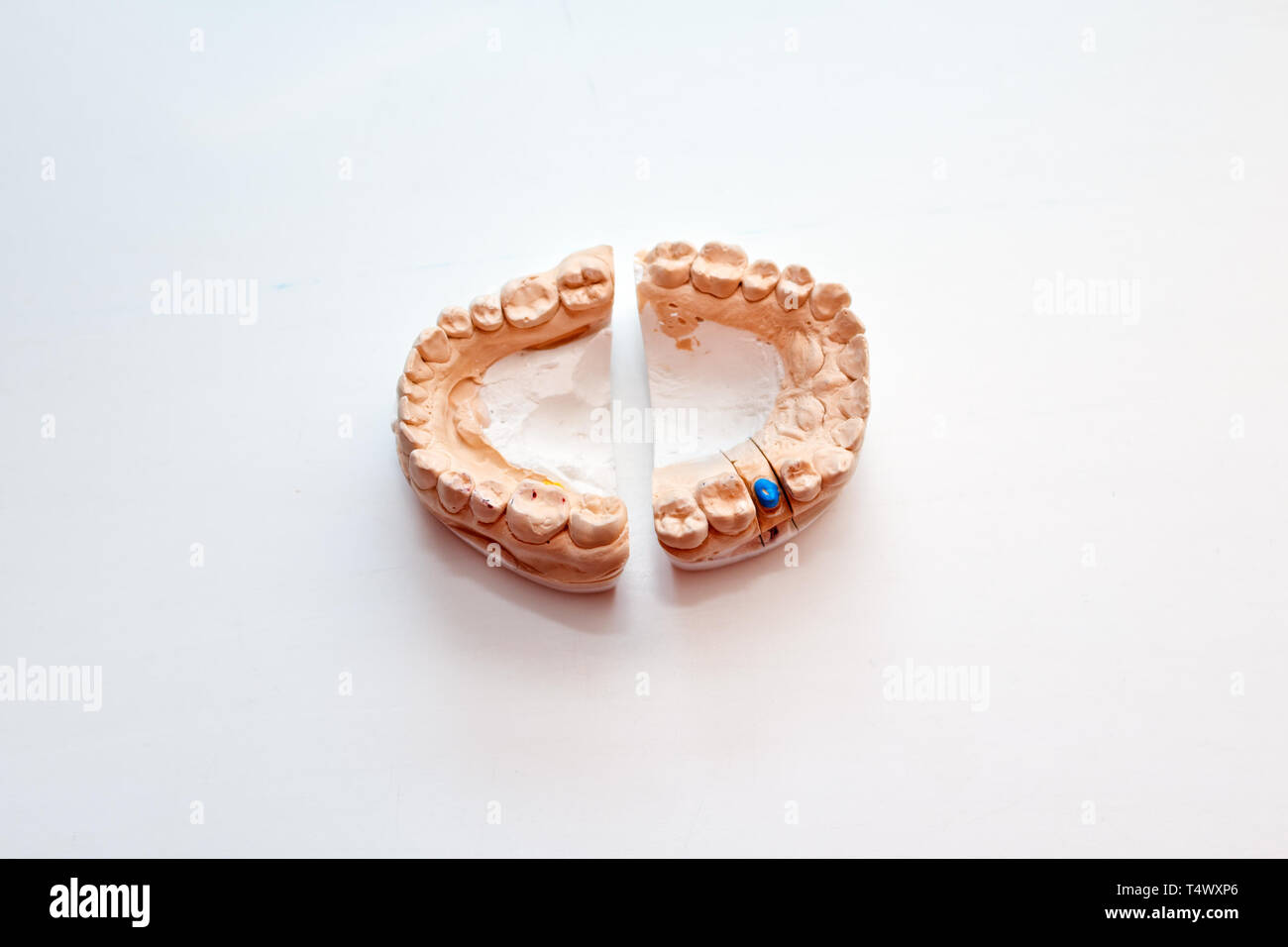 Plaster Cast of jaws. Dental casting gypsum model human Jaws in