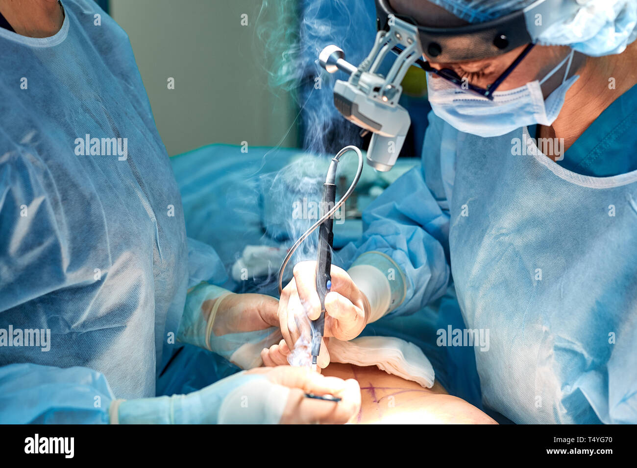 Team of surgeons makes an invasive operation. Portrait of surgeons