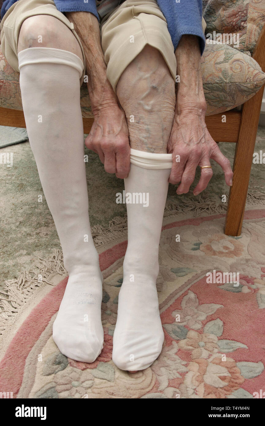 Compression Stockings Stock Photos & Compression Stockings Stock Images
