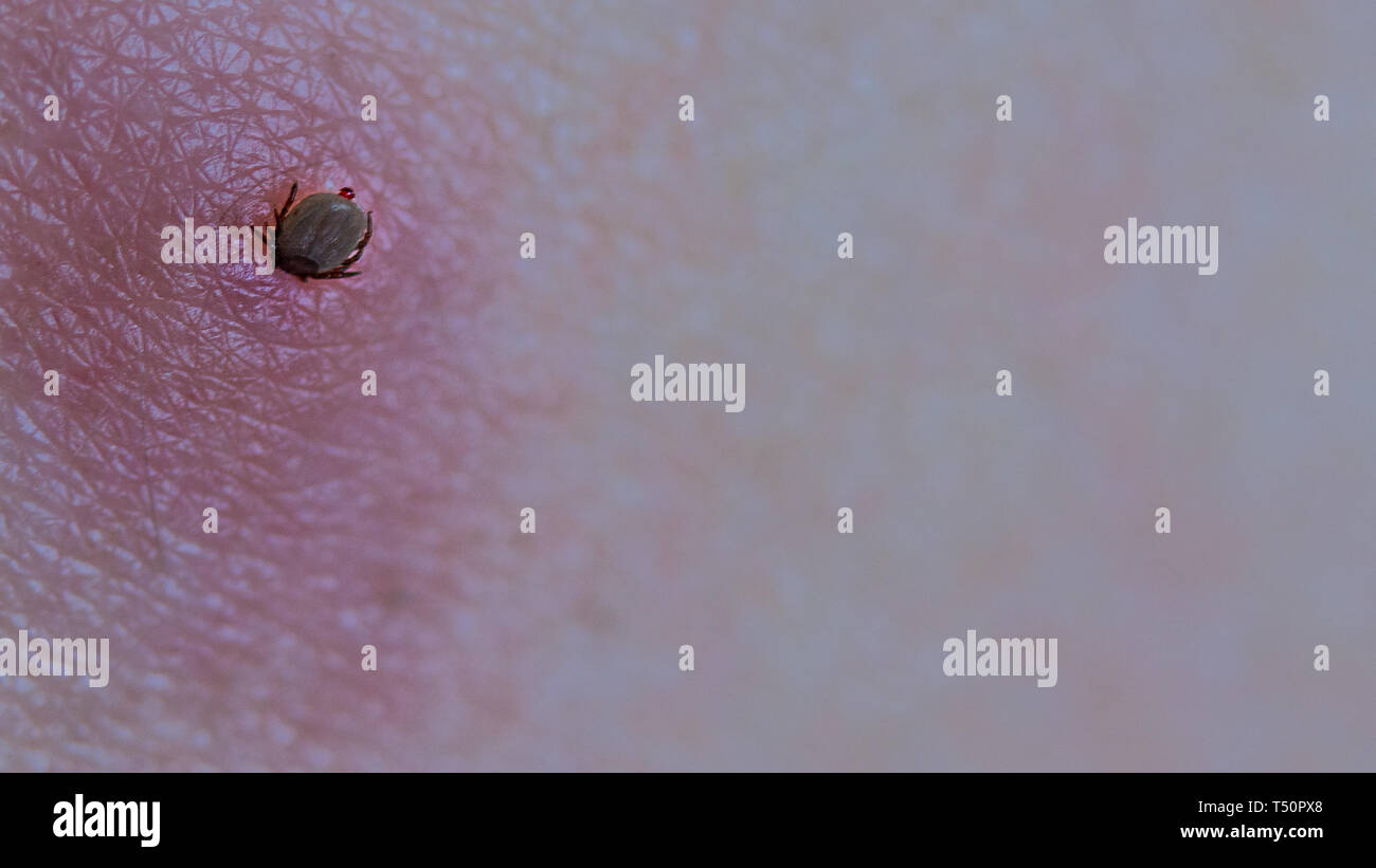 Deer Tick Stock Photos & Deer Tick Stock Images - Alamy