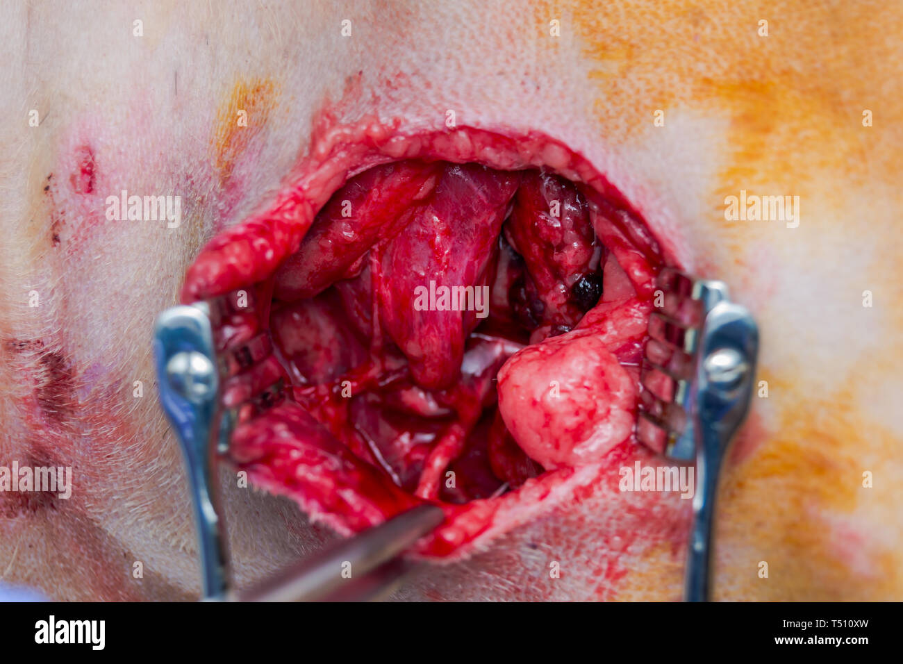 the skin, muscles, blood vessels and nerves destroyed by the  dog bite wound Stock Photo