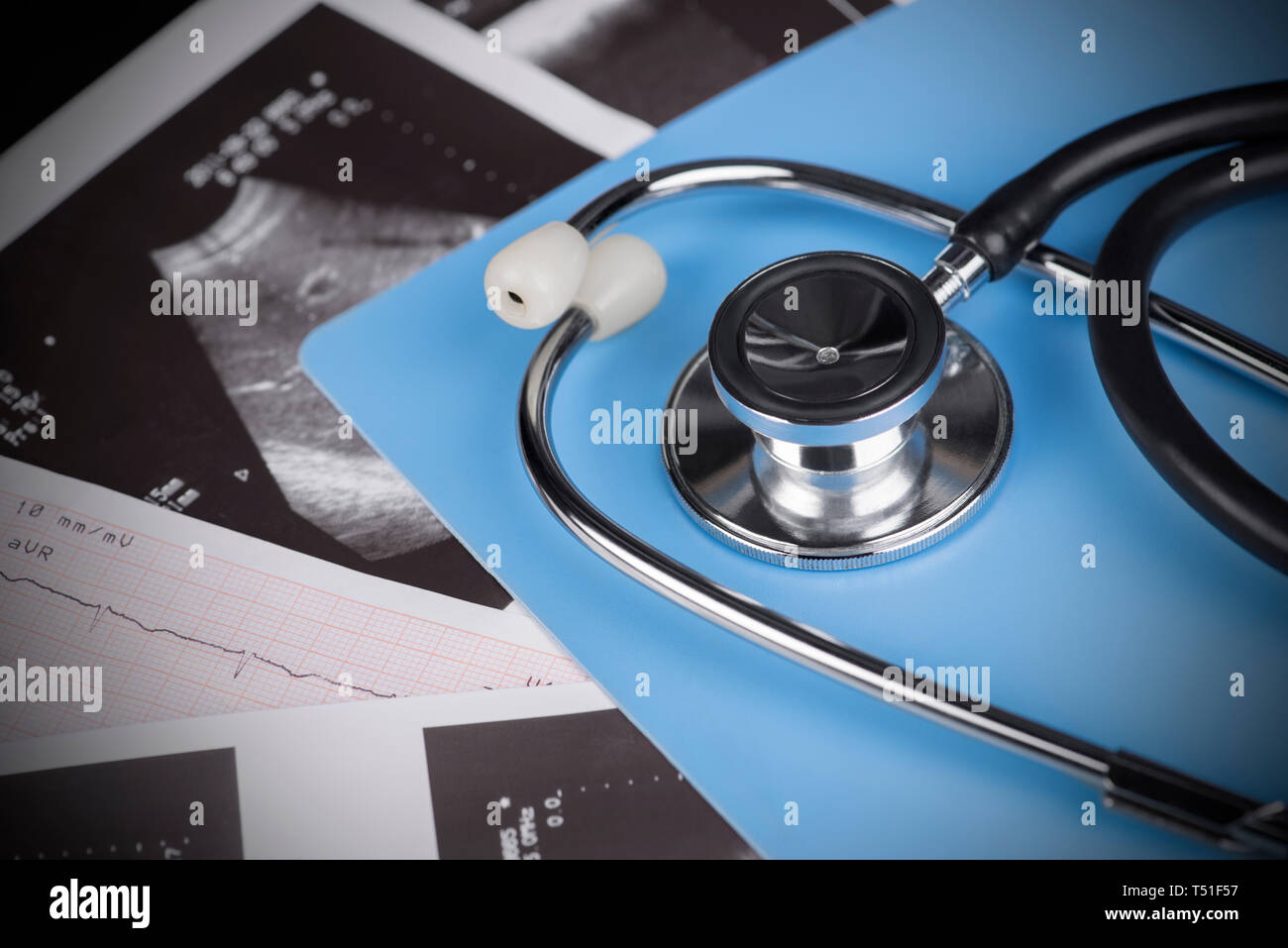 Medical Test - stethoscope, ultrasound shot and cardiogram. Stock Photo