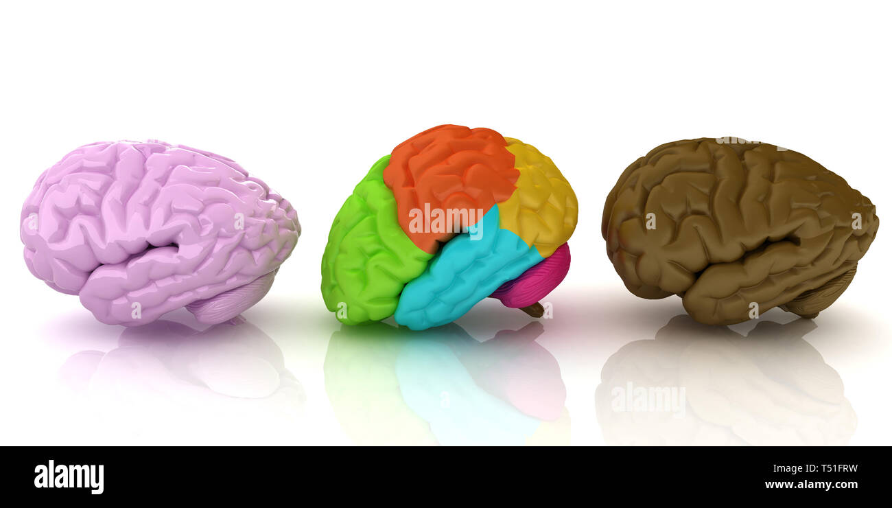 Brains surgery hi-res stock photography and images - Alamy
