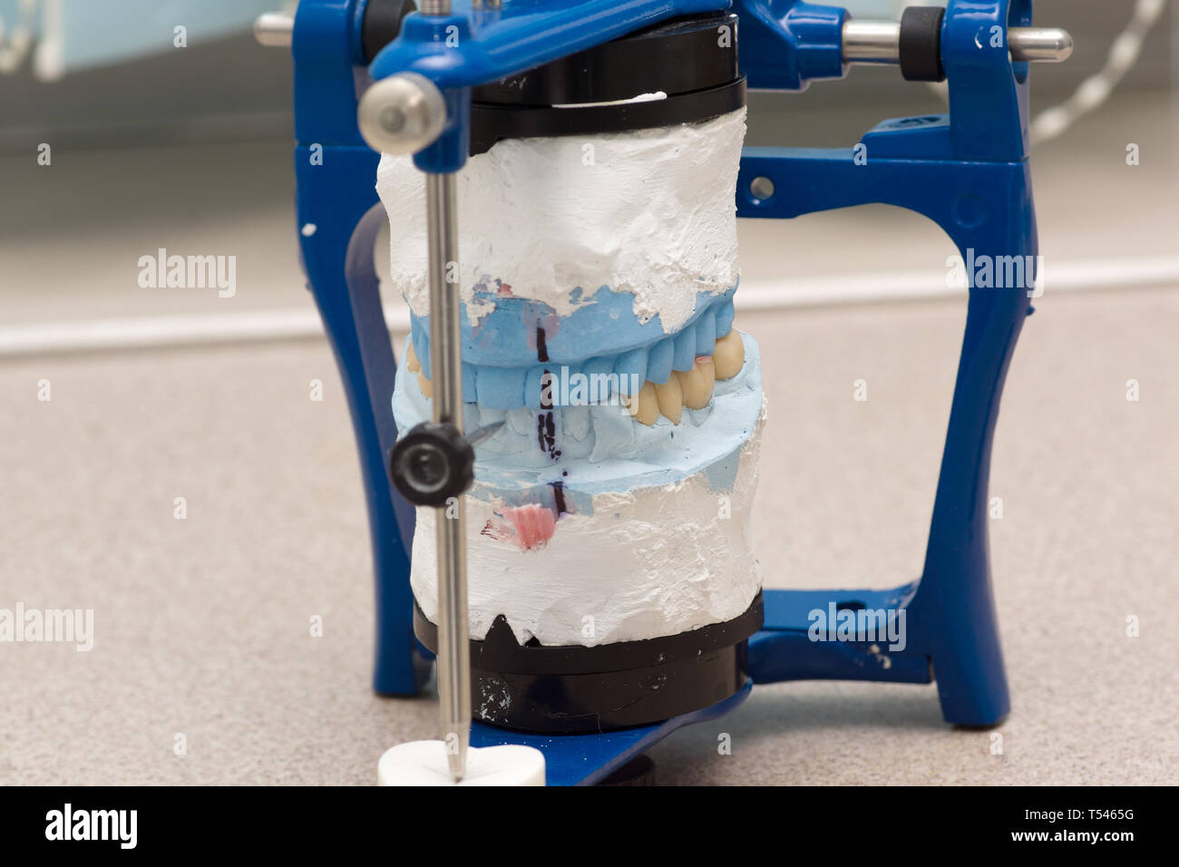 dental articulator with plastered dental bridge models Stock Photo Alamy