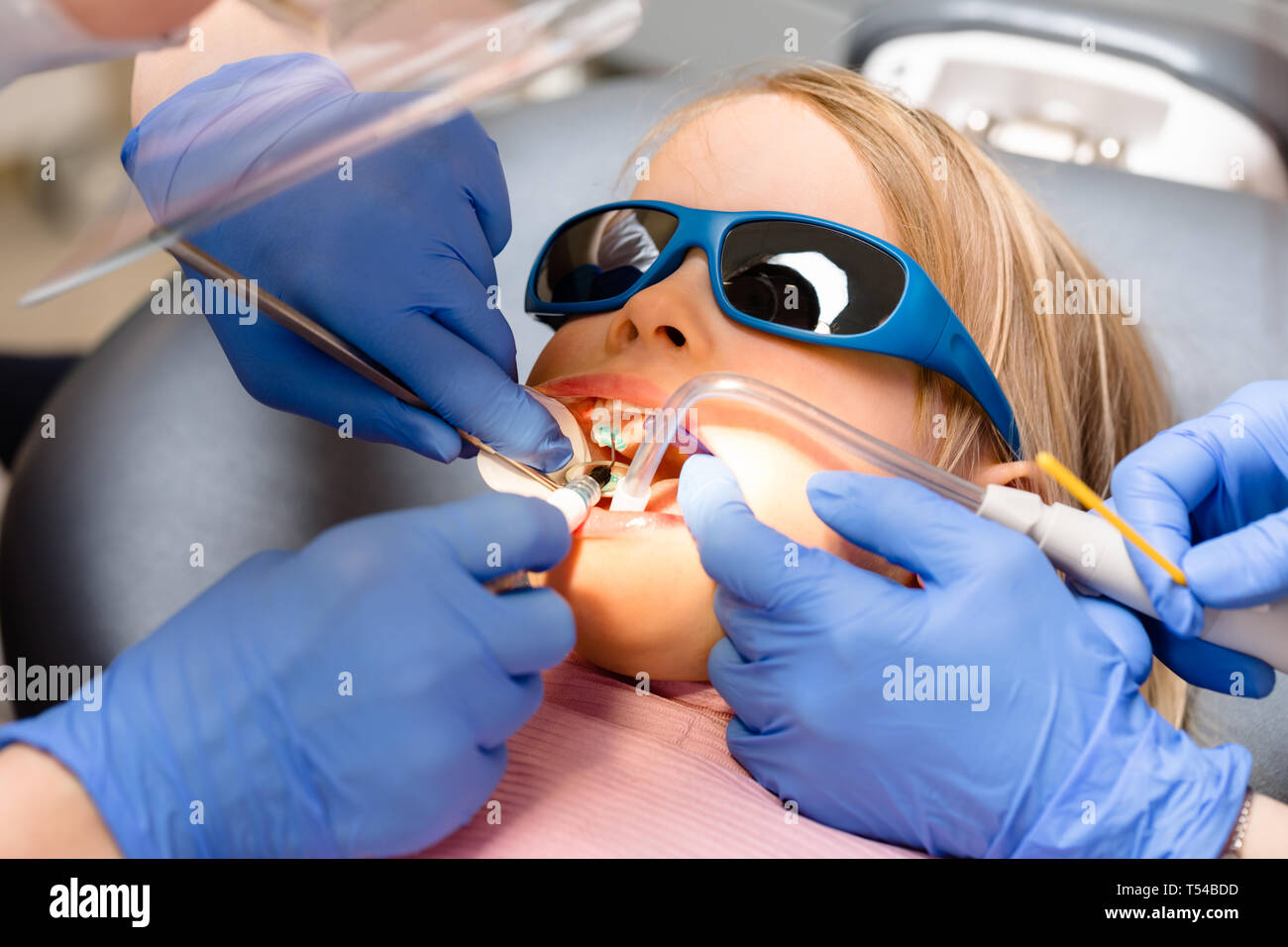 Dentist performing dental procedure to a little girl in pediatric