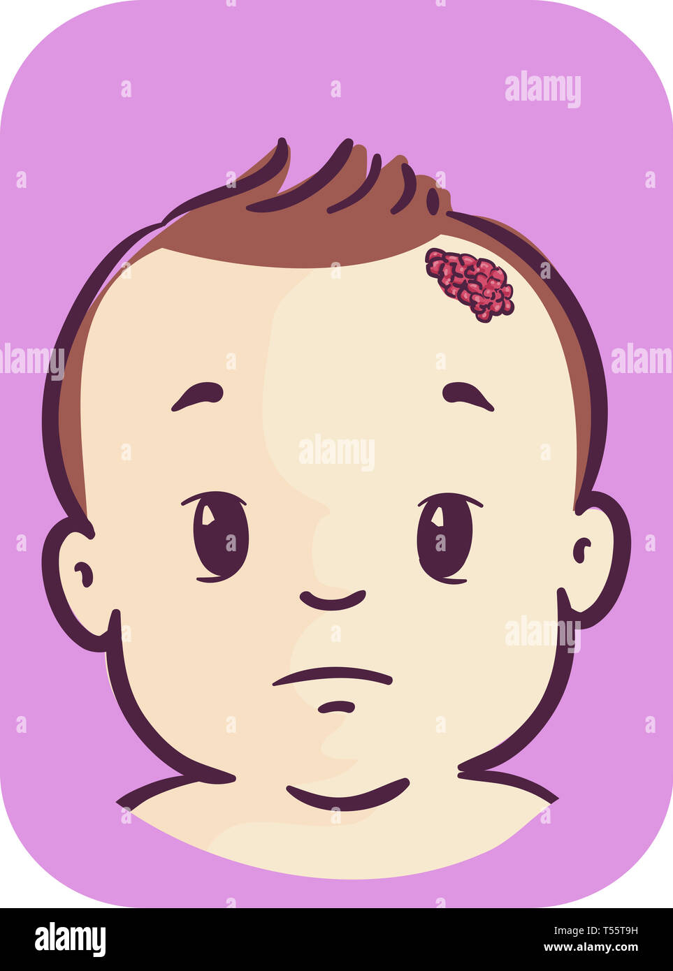Illustration of a Baby Kid Boy with a Strawberry Nevus on His Forehead Stock Photo