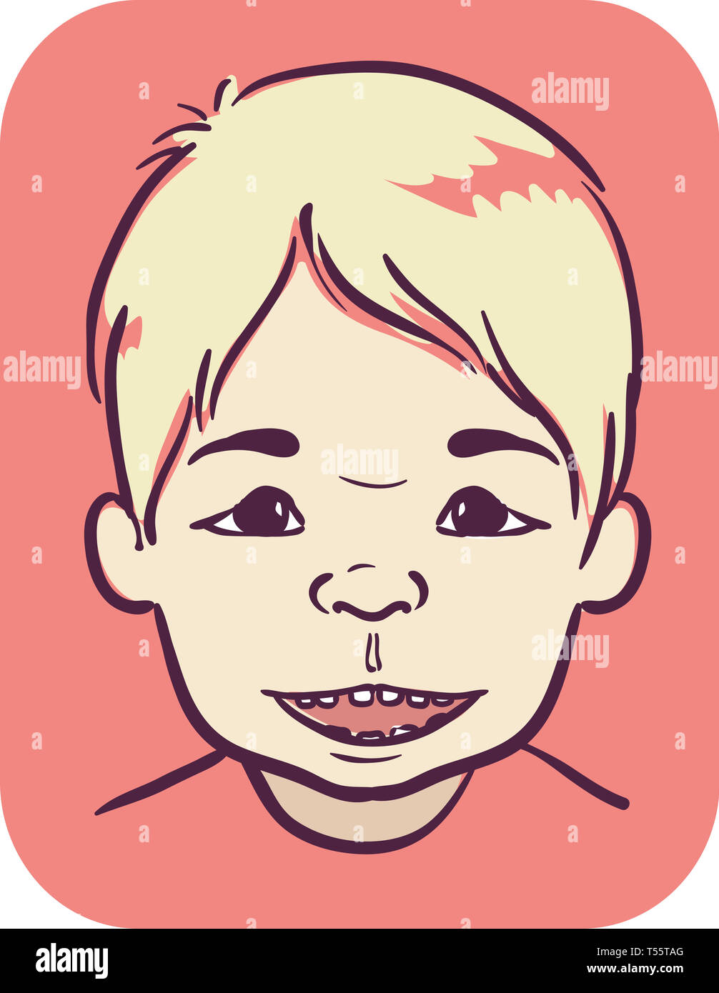 Illustration Of A Kid Boy With Angelman Syndrome Stock Photo - Alamy