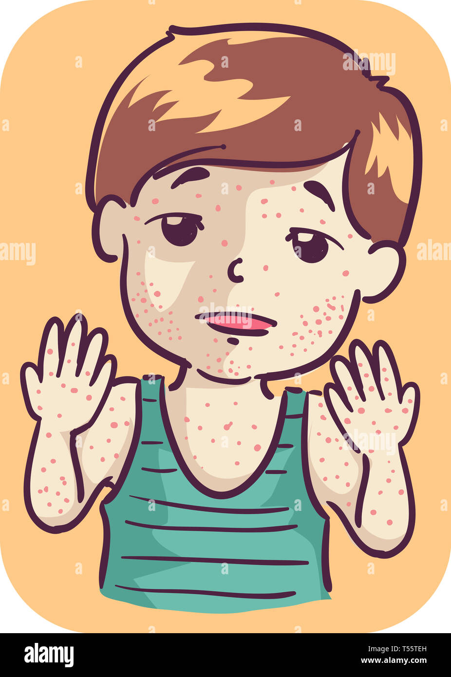 Illustration of a Kid Boy Toddler with Rashes on His Face and Body Stock Photo Alamy
