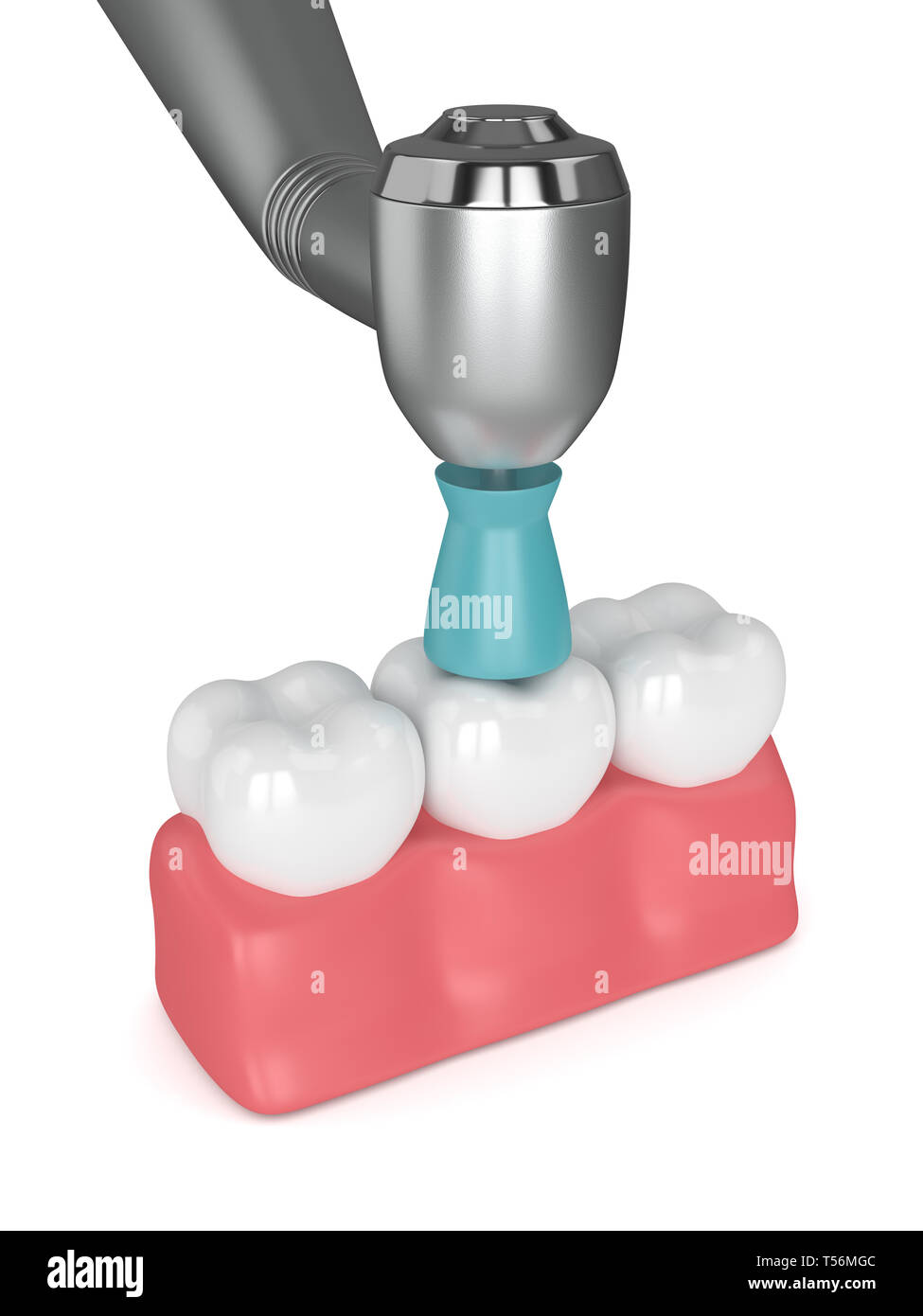 3d render of teeth with dental handpiece and polishing brush. Dental