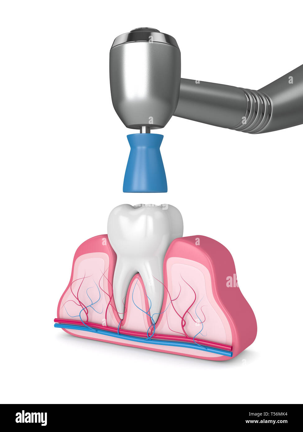 3d render of tooth with dental handpiece and polishing prophy cup