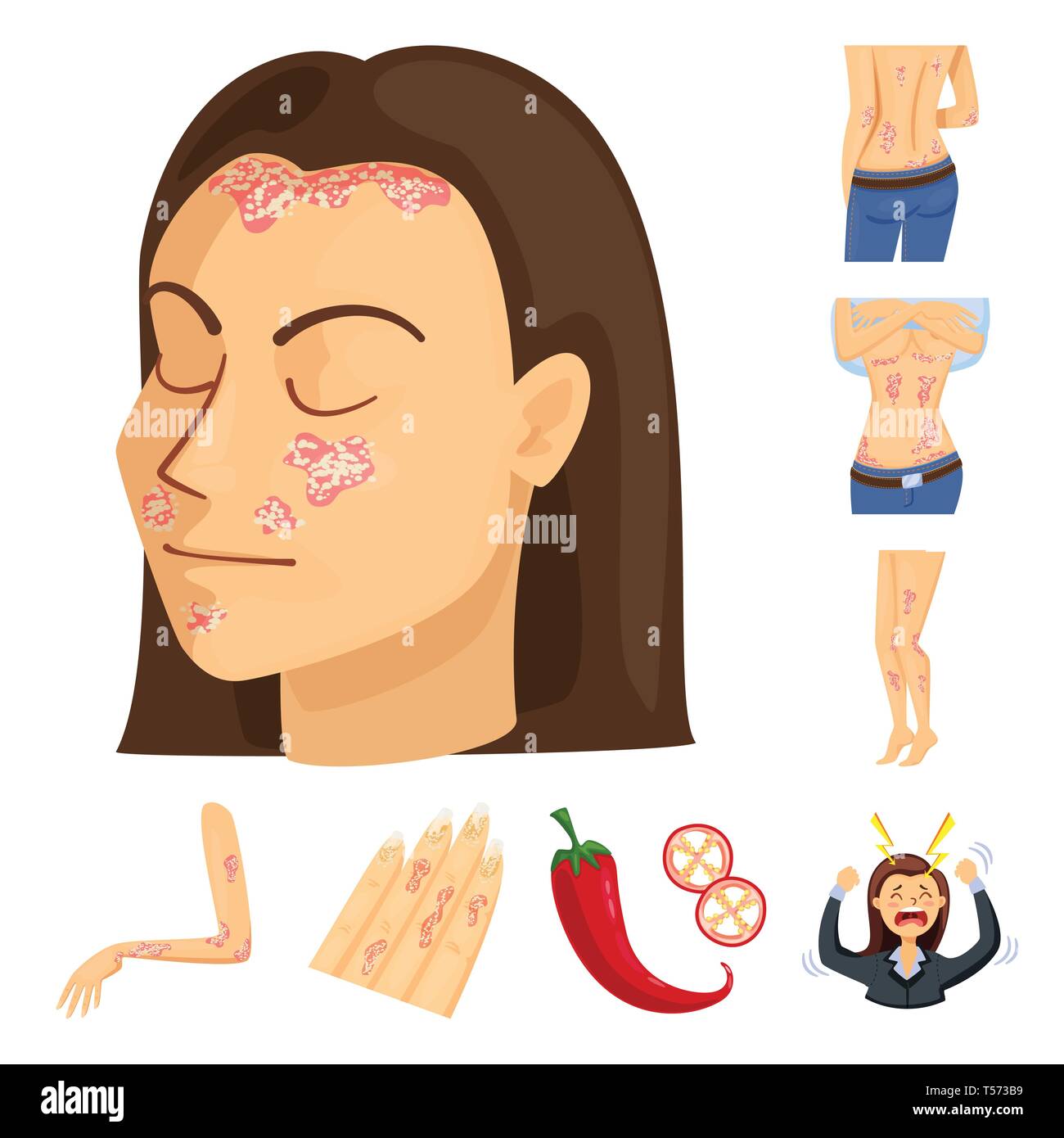 psoriasis,pepper,stress,skin,body,dermatitis,chili,shock,chronic,hot ...