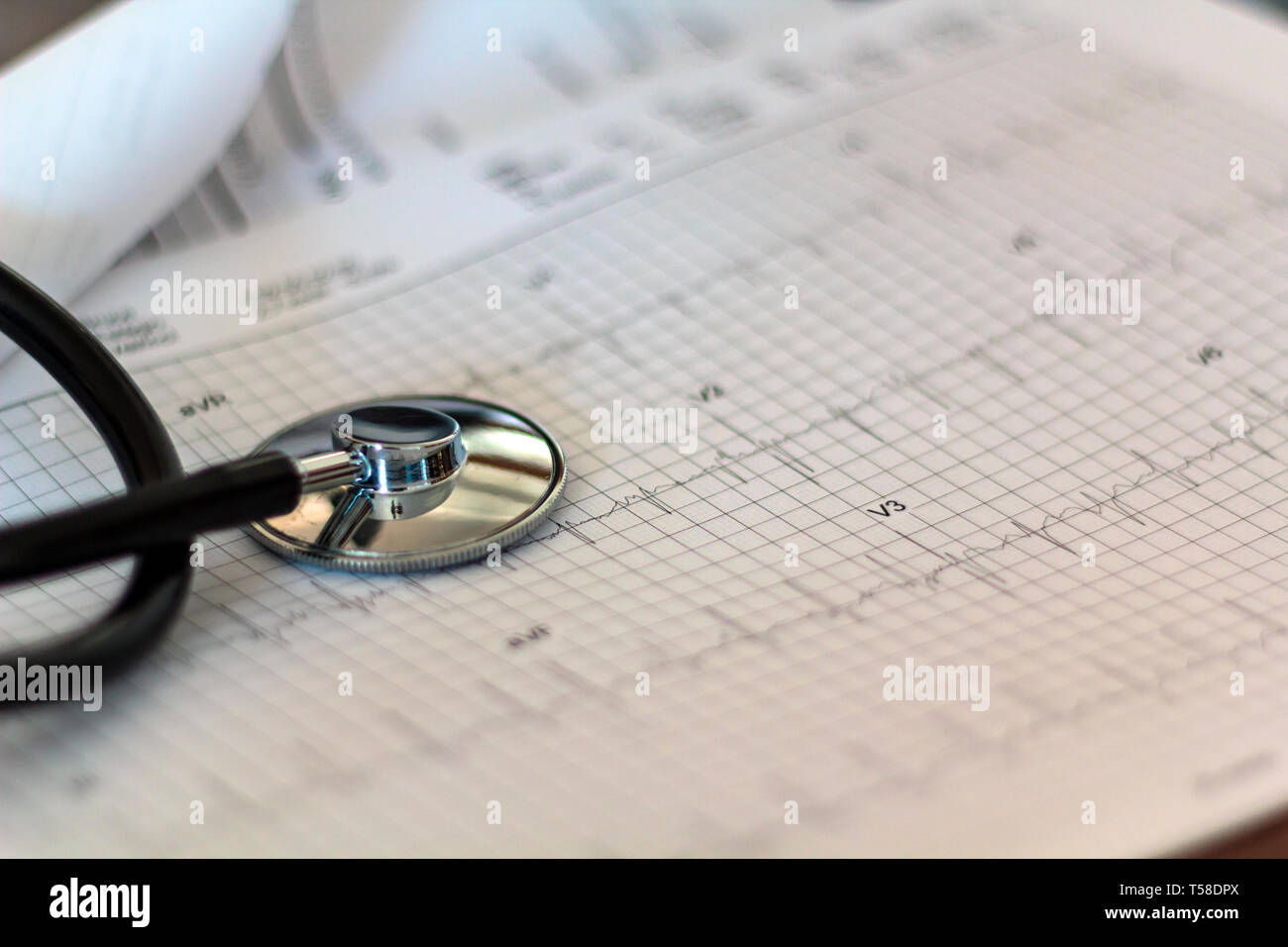 Ecg graph hi-res stock photography and images - Alamy