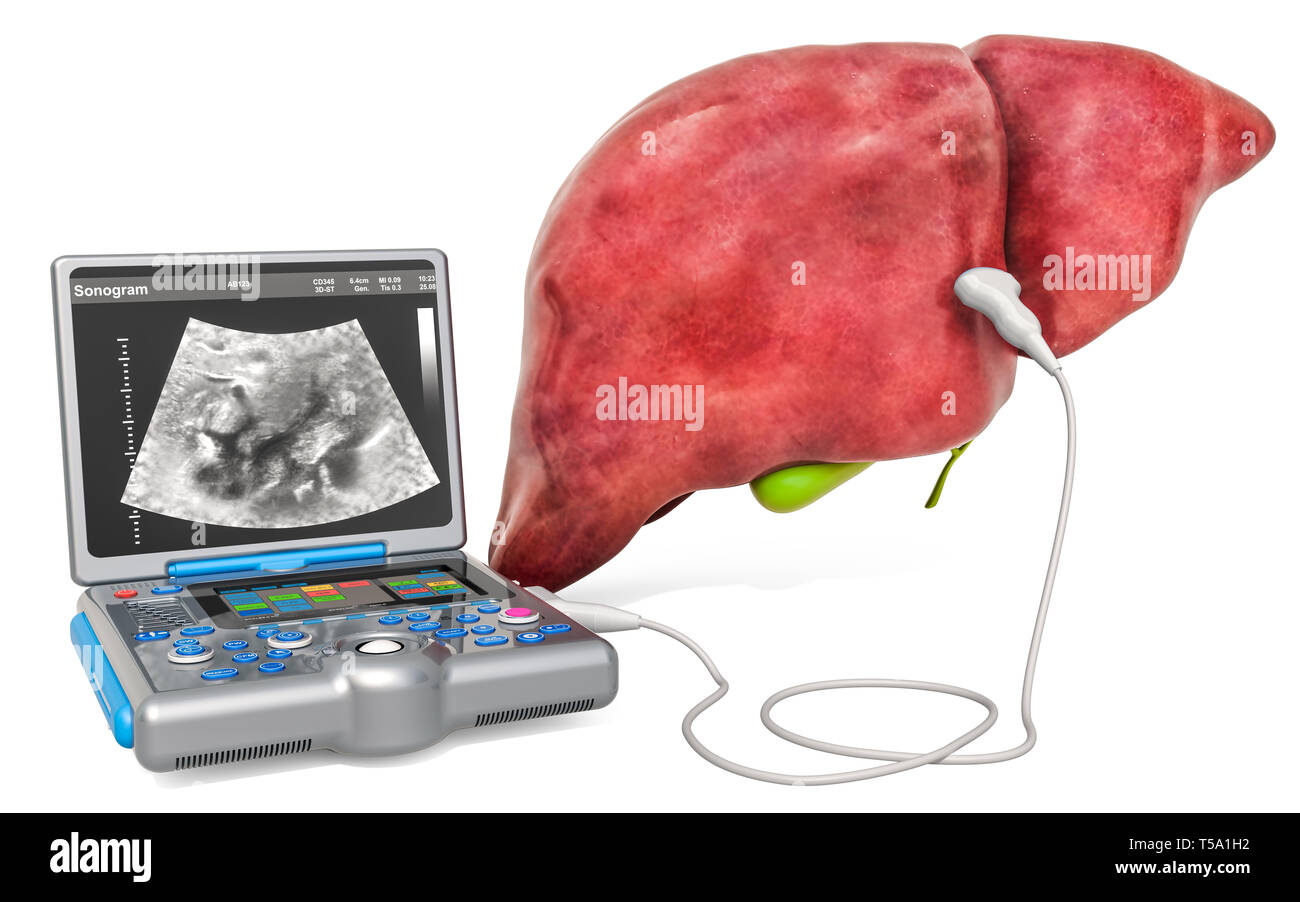 Liver Ultrasound concept. Human liver and gallbladder with medical ultrasound diagnostic machine, 3D rendering isolated on white background Stock Photo