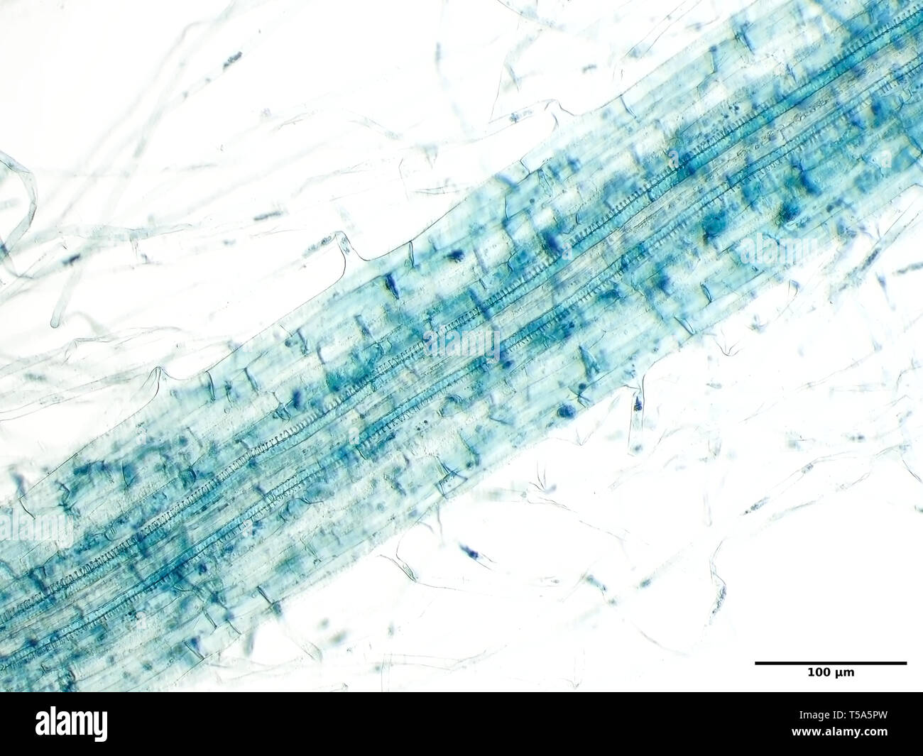 Turnip seedling root with root hairs under the microscope Stock Photo
