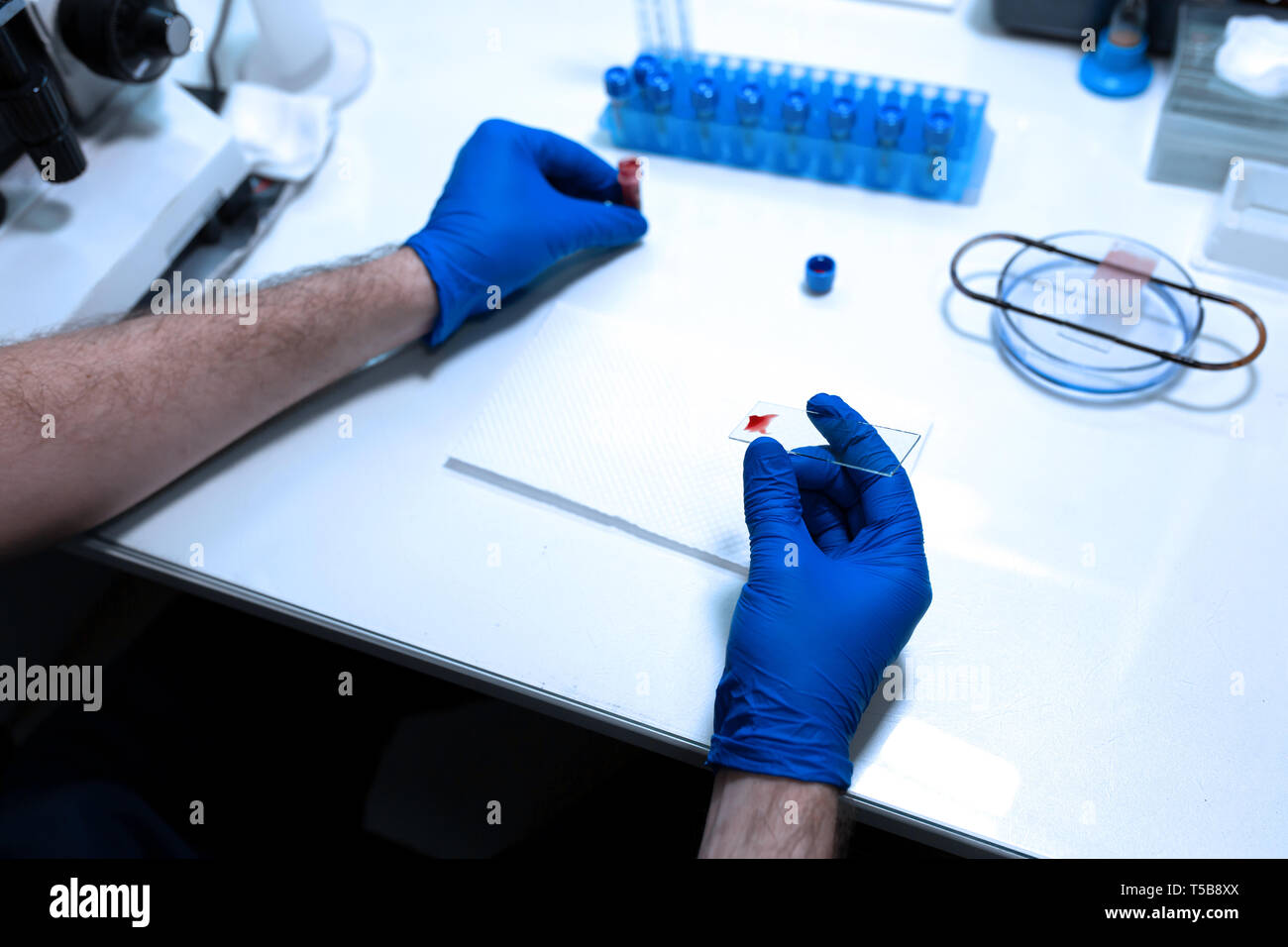 scientist prepare blood sample for research on microscope. Placing