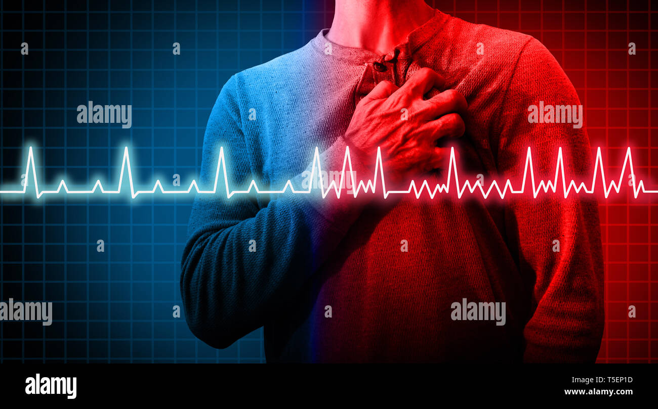 Heart disorder and atrial fibrillation ecg as a coronary cardiac attack with irregular and normal organ rhythm as a chest discomfort disease. Stock Photo