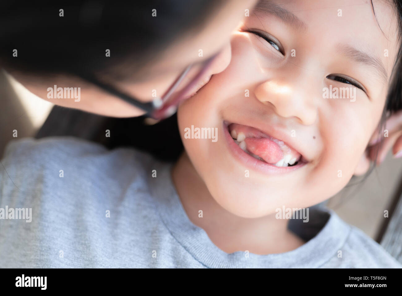 Mother kiss the funny loose teeth girl Stock Photo