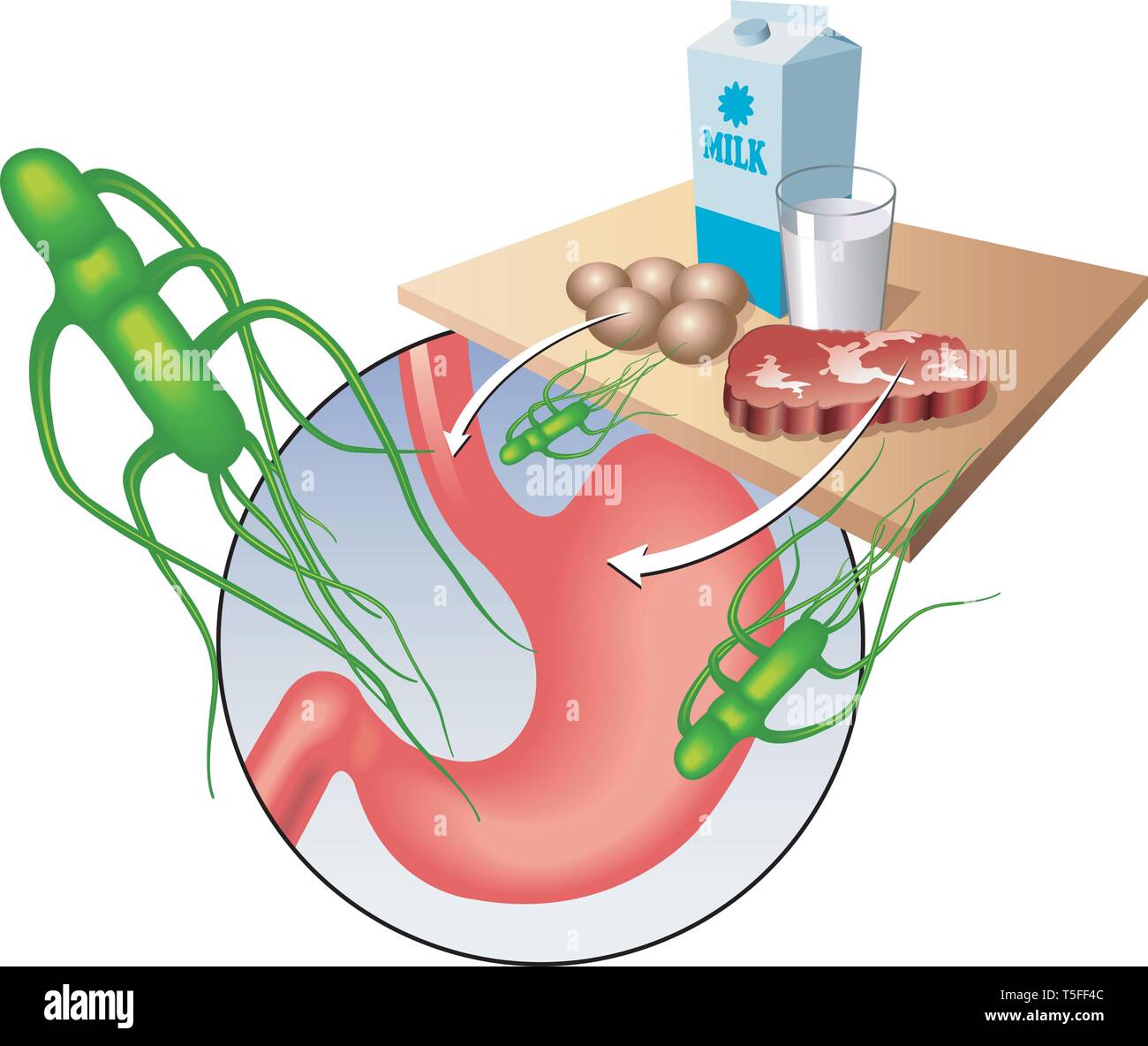 Medical illustration showing the salmonella virus and the main contaminated foods. Stock Vector