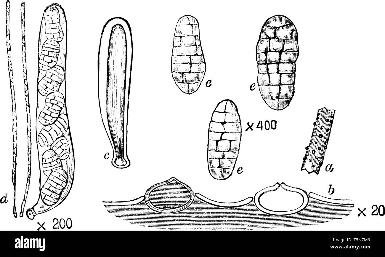 An image of Pleospora Herbarum in Perfect Stage. Pleospora herbarum is a species of fungus in the Pleosporaceae family. An image shows the Pleospora h Stock Vector