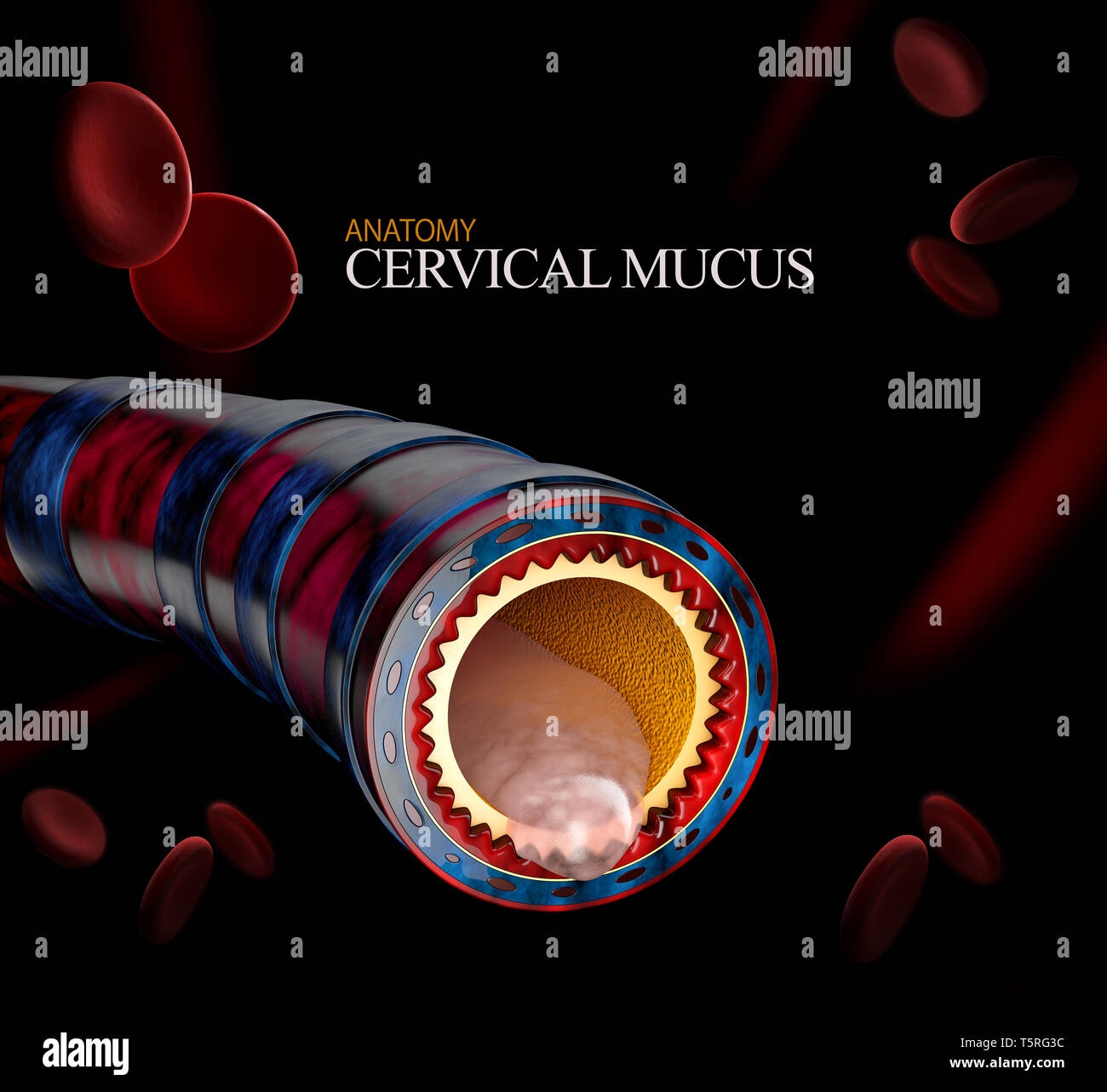 Bronchitis anatomy, mucus secreted as a chest cold as a 3D illustration