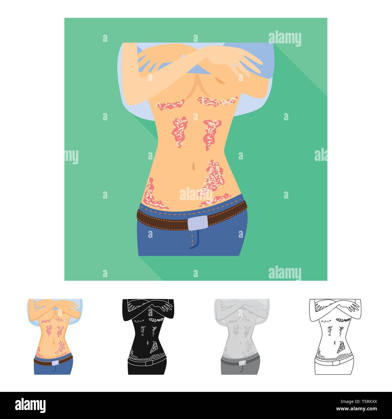 Isolated object of psoriasis and body symbol. Collection of psoriasis ...