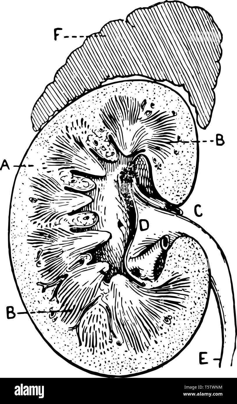 Slagter - Drawing Anatomy of kidney, nephron and glomerulus - number labels  | AnatomyTOOL
