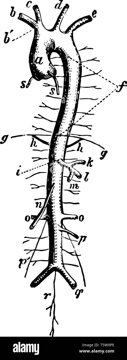 Arch Of Aorta Diagram