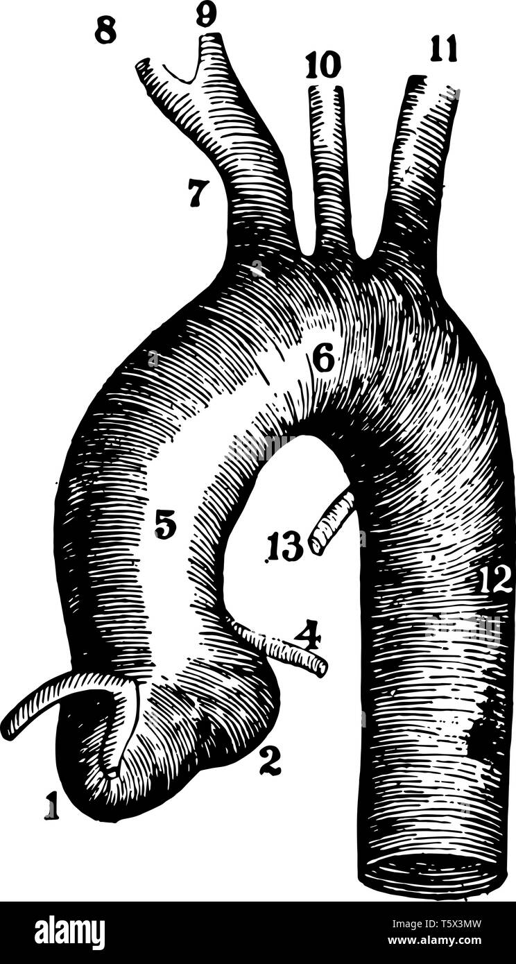 This diagram represents The Aorta and Connecting Arteries vintage line