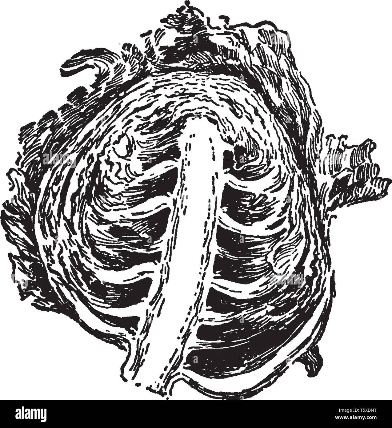 This is a intersection image of Cabbage Head and the thickened rachis ...