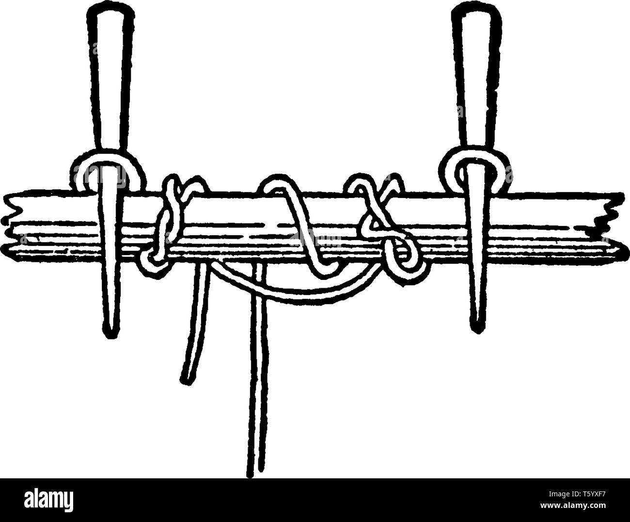 This illustration represents Spanish Windlass, vintage line drawing or
