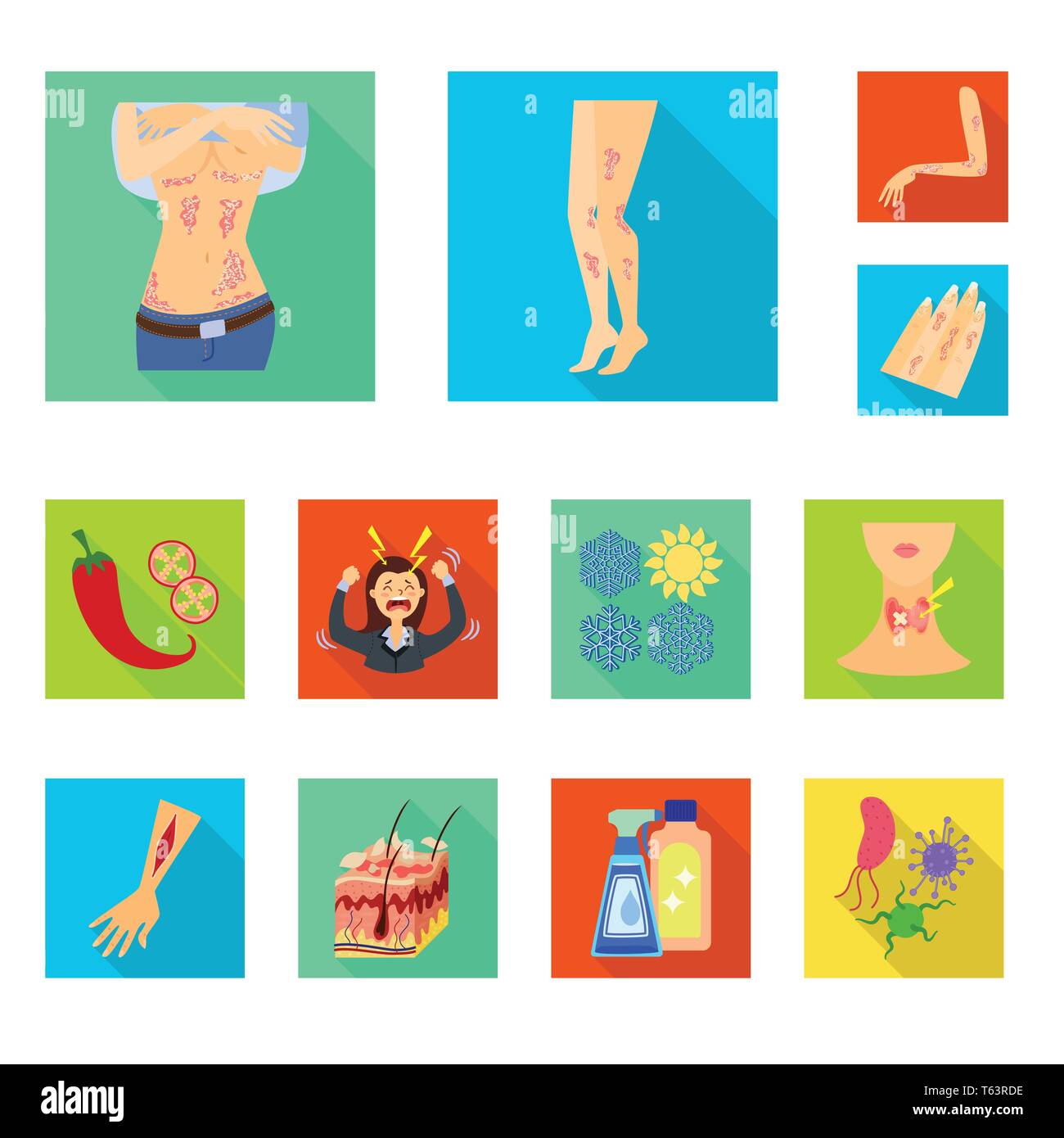 psoriasis,pepper,stress,snowflake,endocrine,injury,skin,chemical