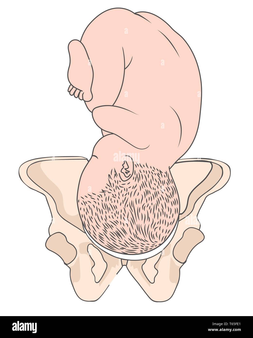 Left Occiput Anterior LOA Baby Fetal Position Pelvis  ROA Right Stock Vector