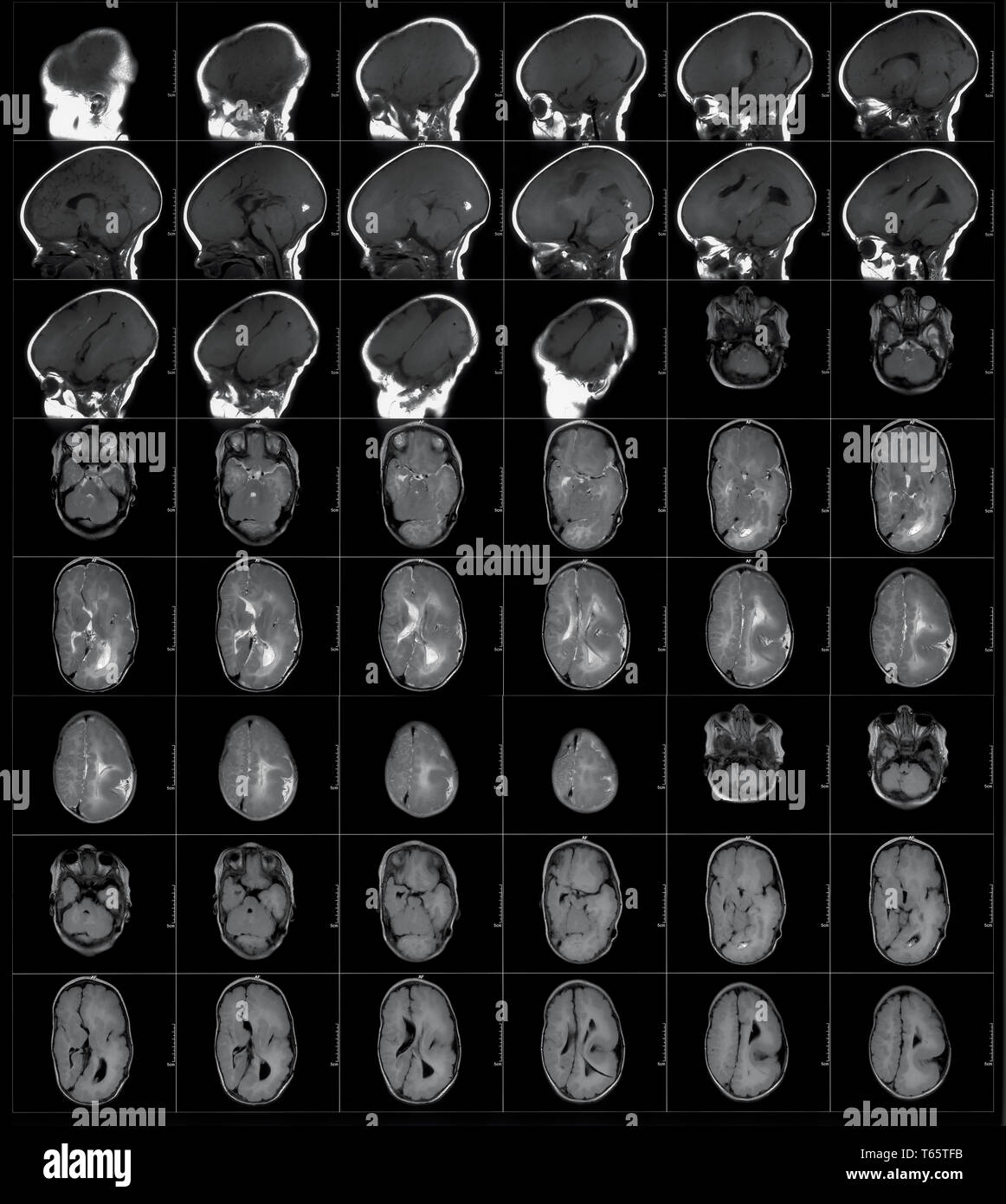 MRI scan Stock Photo