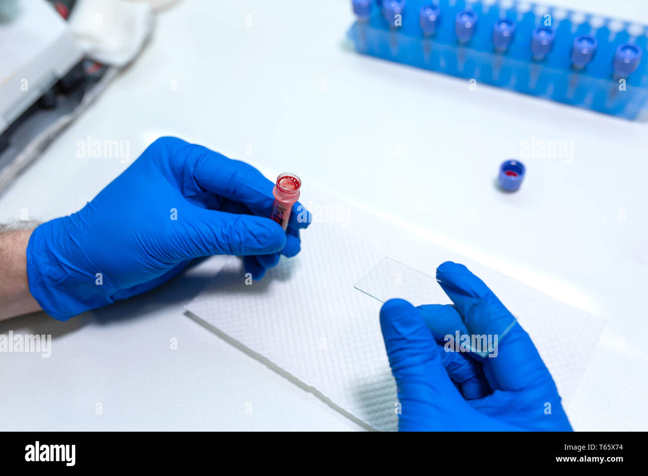 scientist prepare blood sample for research on microscope. Placing
