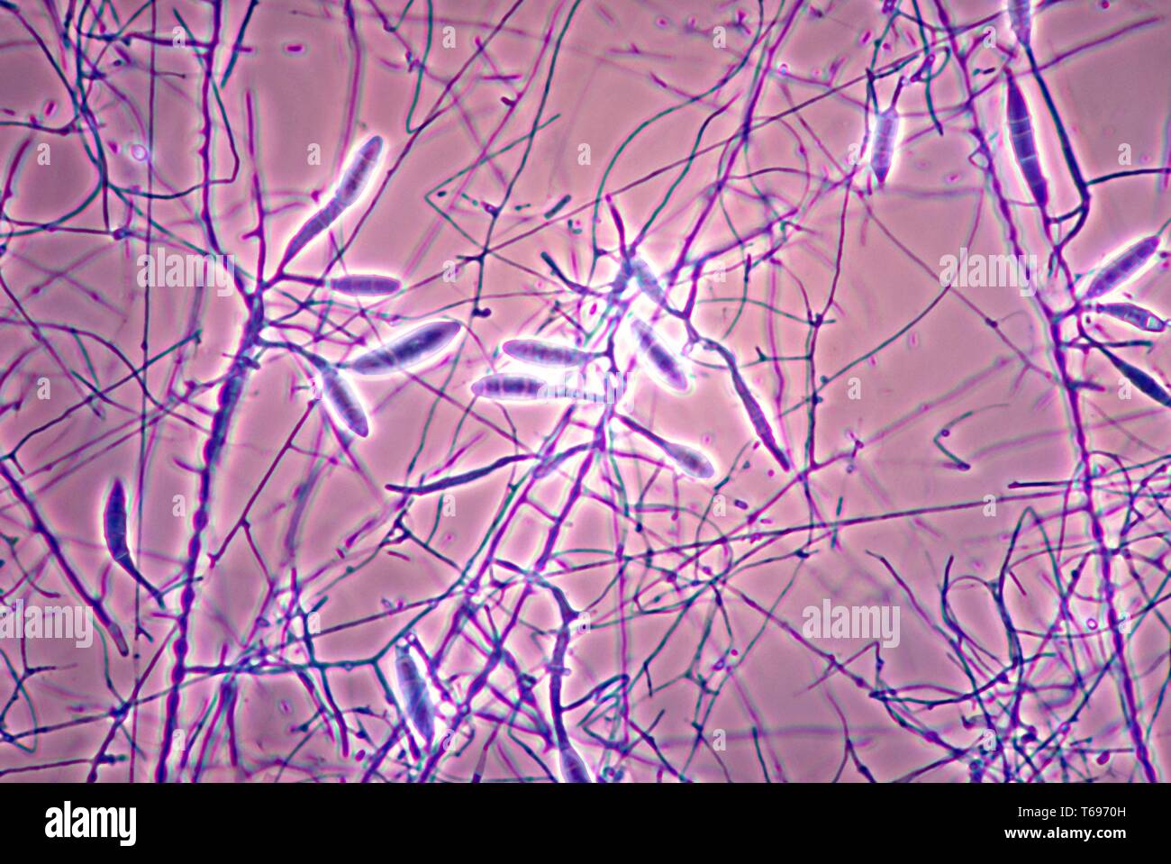 Photomicrograph of the mycelia, conidiophores, and conidia of the fungus Microsporum gallinae, 1978. Image courtesy Centers for Disease Control and Prevention (CDC) / Dr Libero Ajello. () Stock Photo