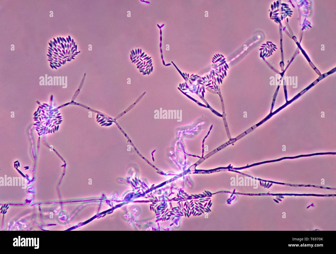 Photomicrograph of the conidia and conidiophores of the fungus Fusarium verticillioides, 1978. Image courtesy Centers for Disease Control and Prevention (CDC) / Dr Libero Ajello. () Stock Photo
