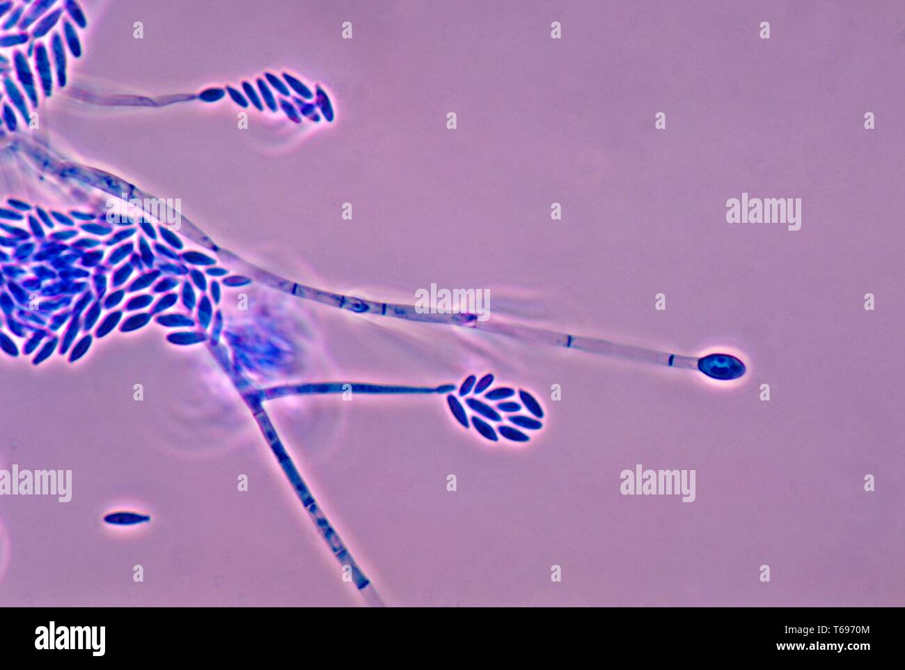 Photomicrograph of the conidia and conidiophores of the fungus Fusarium verticillioides, 1978. Image courtesy Centers for Disease Control and Prevention (CDC) / Dr Libero Ajello. () Stock Photo