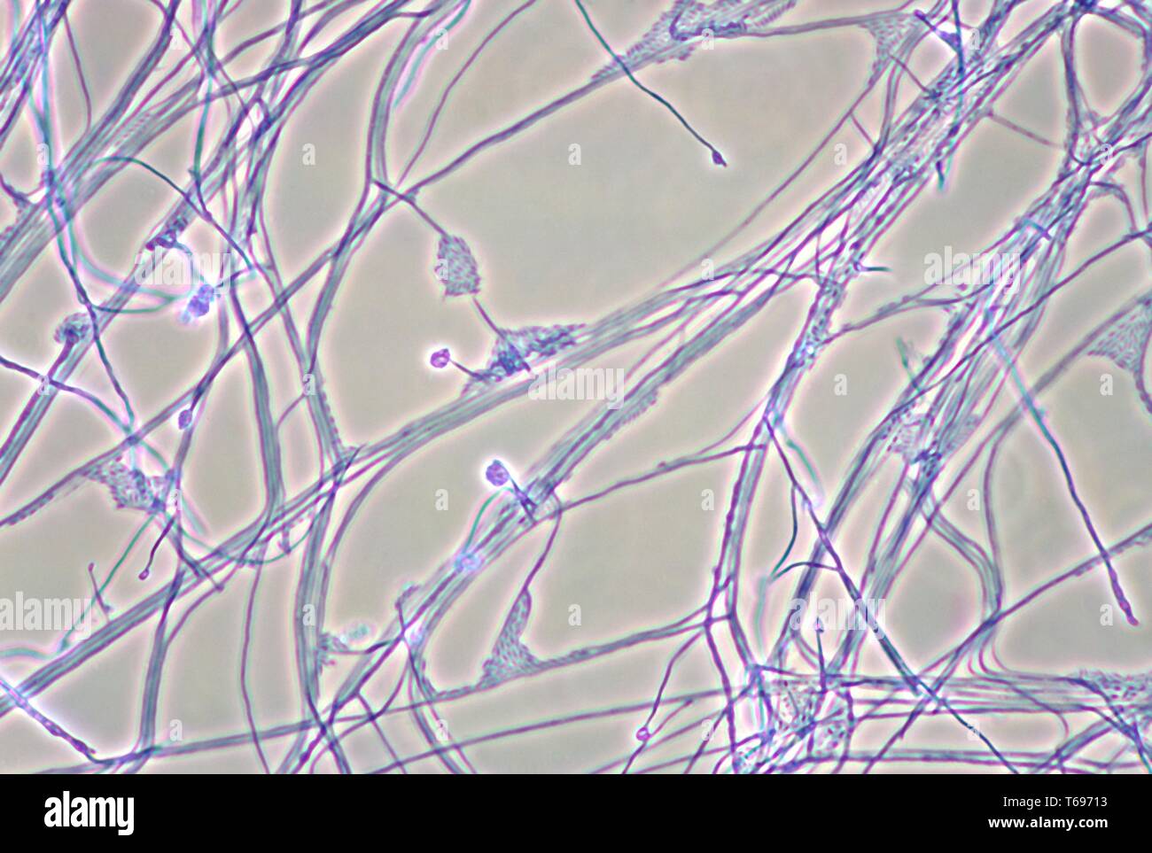 Photomicrograph of the mycelia, conidiophores, and conidia of the fungus Acremonium recifei, 1978. Image courtesy Centers for Disease Control and Prevention (CDC) / Dr Arvind A. Padhye. () Stock Photo