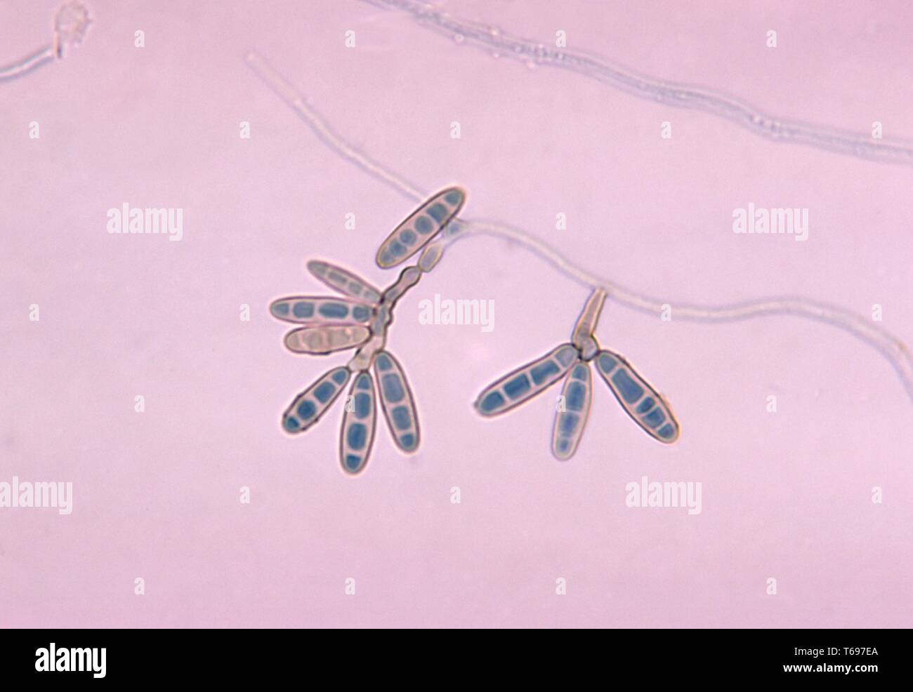 Photomicrograph of conidia and conidiophores of a Helminthosporium fungus, 1970. Image courtesy of CDC. () Stock Photo