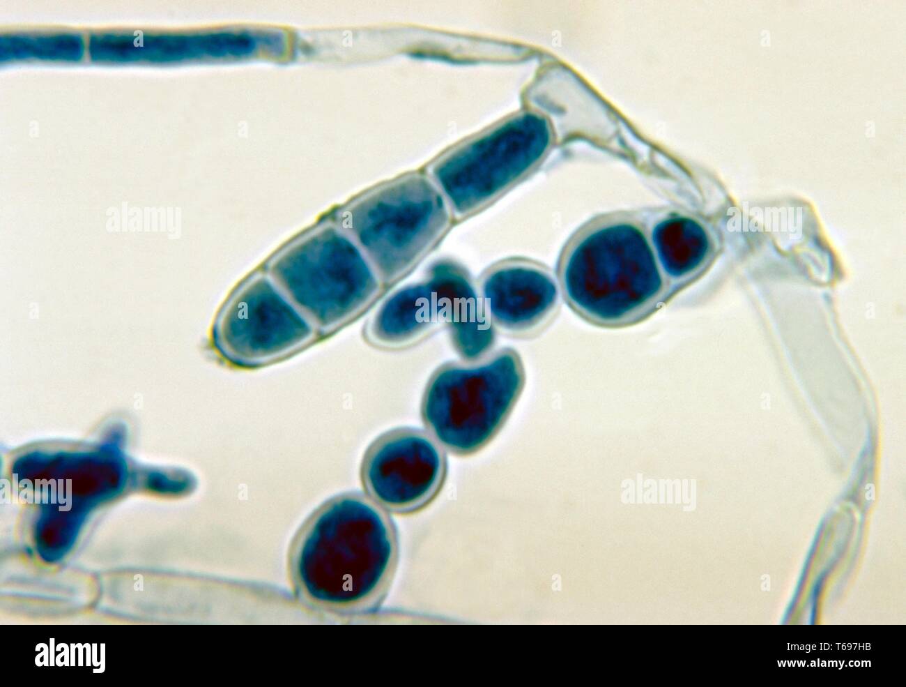 Photomicrograph of the macroconidia of the dermatophytic fungus Epidermophyton floccosum, 1972. Image courtesy Centers for Disease Control and Prevention (CDC) / Dr Libero Ajello. () Stock Photo