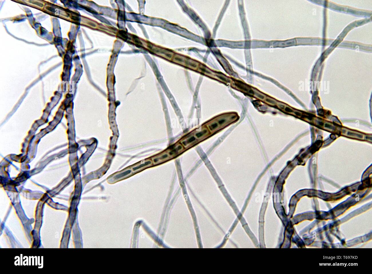 Photomicrograph of the mold Corynespora cassiicola of the group Fungi Imperfecti, 1972. Image courtesy Centers for Disease Control and Prevention (CDC) / Dr Libero Ajello. () Stock Photo
