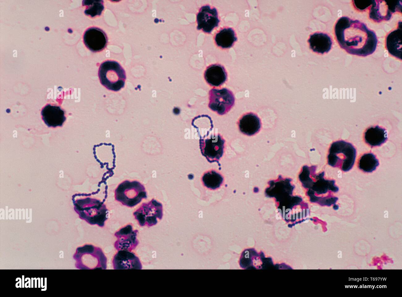 This is a photomicrograph of a blood culture specimen, depicts numbers of Gram-positive, a-hemolytic viridans streptococci group bacteria, most of which were arranged in two long chains, 1978. The viridans streptococci group of bacteria is composed of a number of streptococcal species that are either a-hemolytic, or non-hemolytic. Image courtesy CDC/Dr. Mike Miller. Stock Photo