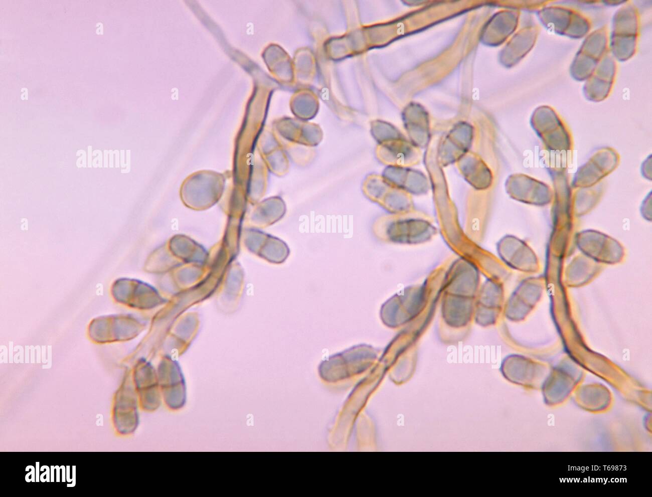 Photomicrograph of conidia-laden conidiophores of the anamorphic fungus Exophiala salmonis, 1970. Image courtesy Centers for Disease Control and Prevention (CDC) / Dr Libero Ajello. () Stock Photo