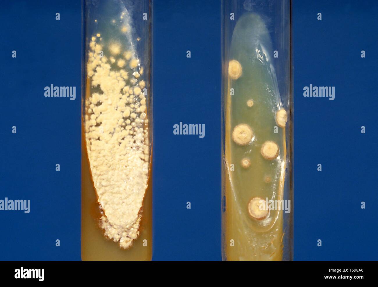 Slant cultures of the dimorphic fungus histoplasma capsulatum colonies ...