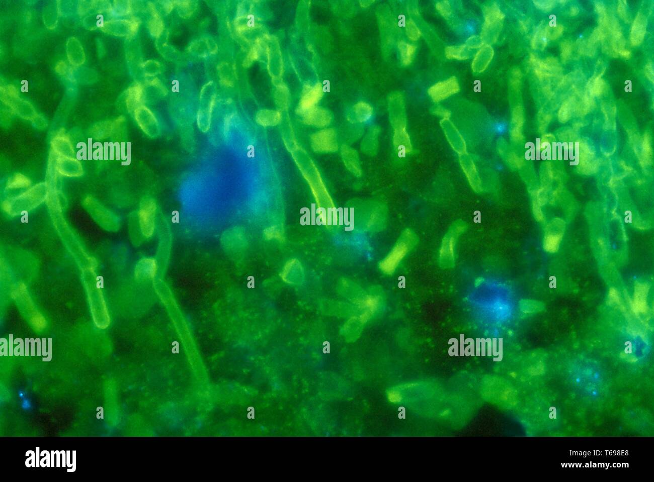 Fluorescent antibody stain hires stock photography and images Alamy