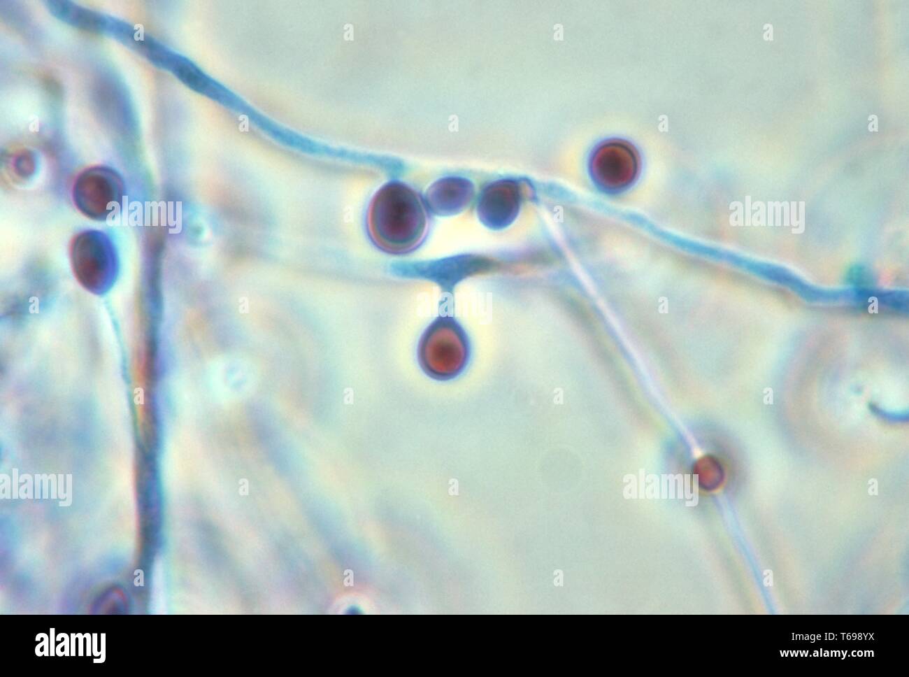 Photomicrograph of the conidiophore and conidia of the fungus Pseudallescheria boydii, 1970. Image courtesy Centers for Disease Control and Prevention (CDC). () Stock Photo