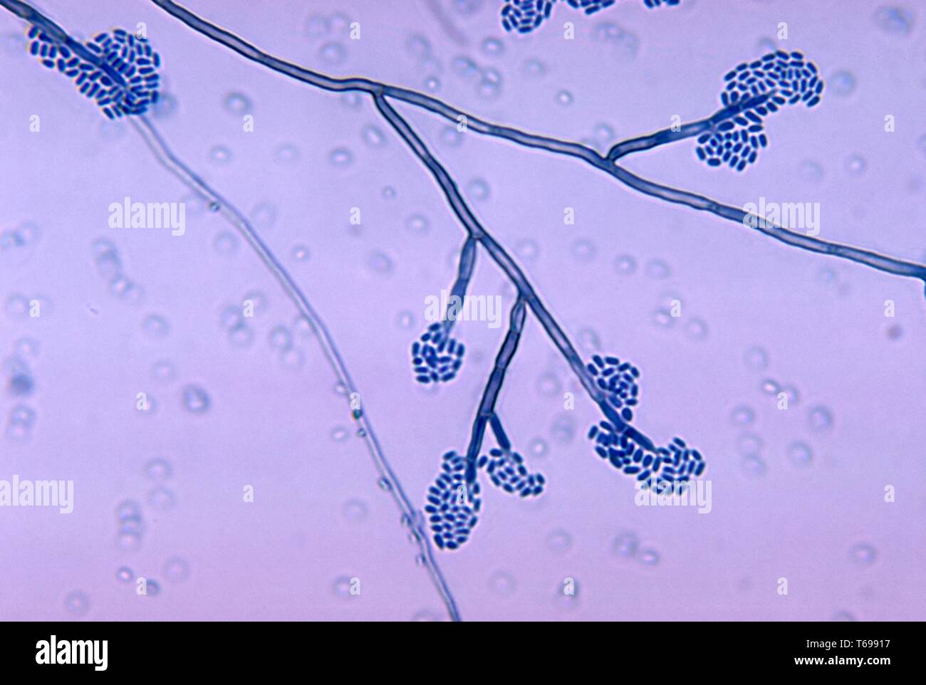 Photomicrograph of the conidiophores of the saprotrophic fungus Exophiala jeanselmei (Phialophora jeanselmei), 1970. Image courtesy Centers for Disease Control and Prevention (CDC) / Dr Libero Ajello. () Stock Photo