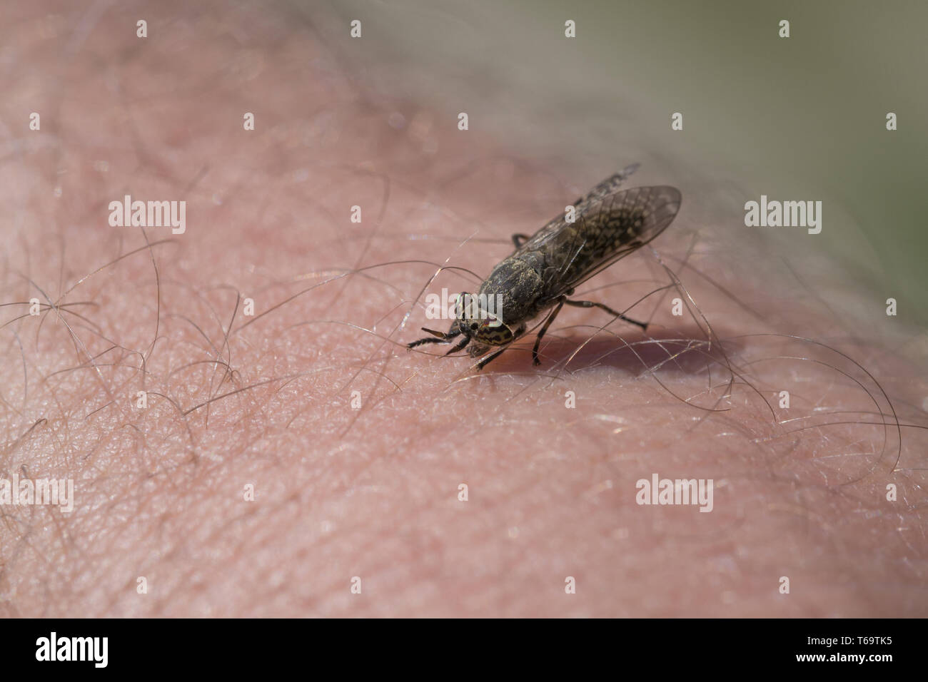 Botfly stands in human skin Stock Photo